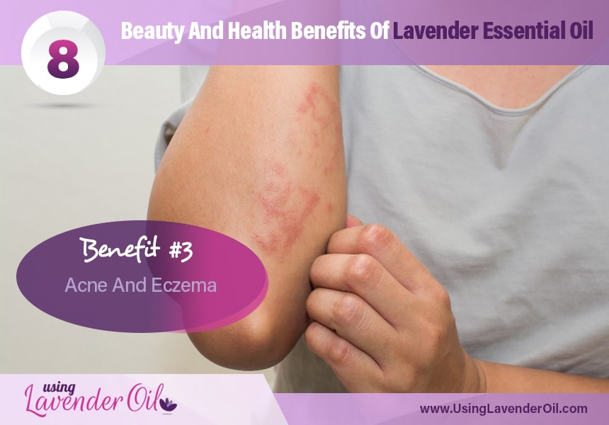  lavender oil for skin